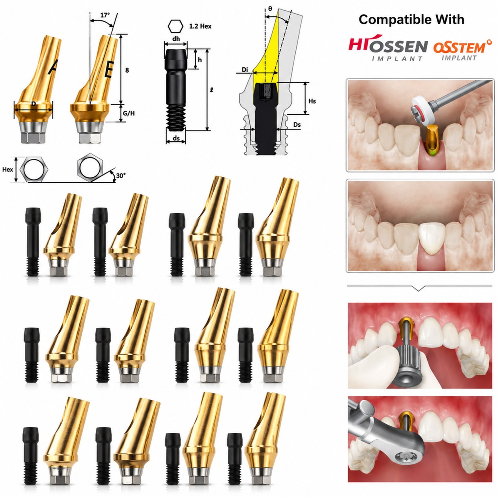 US Dental 17° Angled Abutment For Hiossen ET III Osstem TS Mini Regular Platform