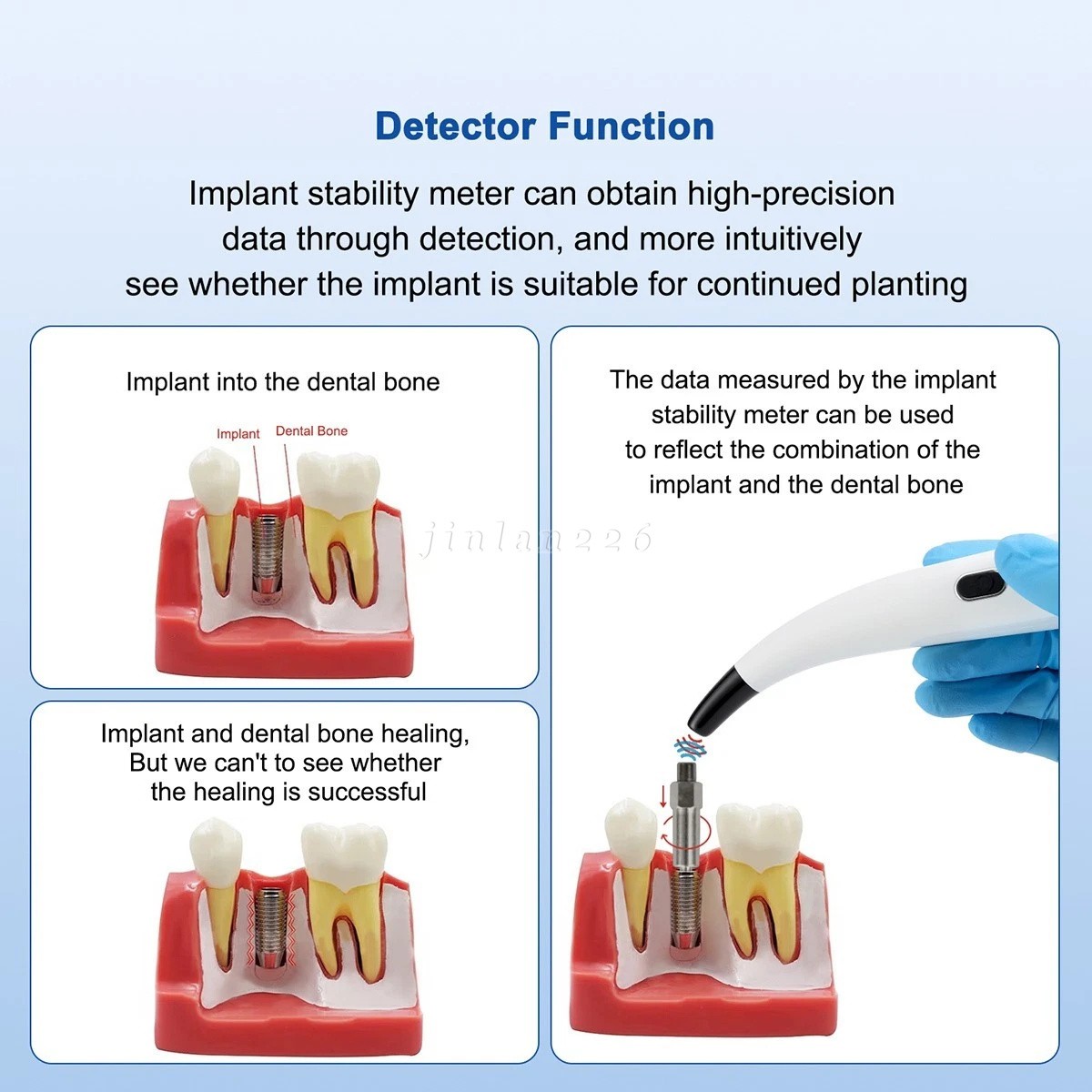 Handheld Dental Fit Osstell Beacon Isq Implant Stability Meter Tool Instrument
