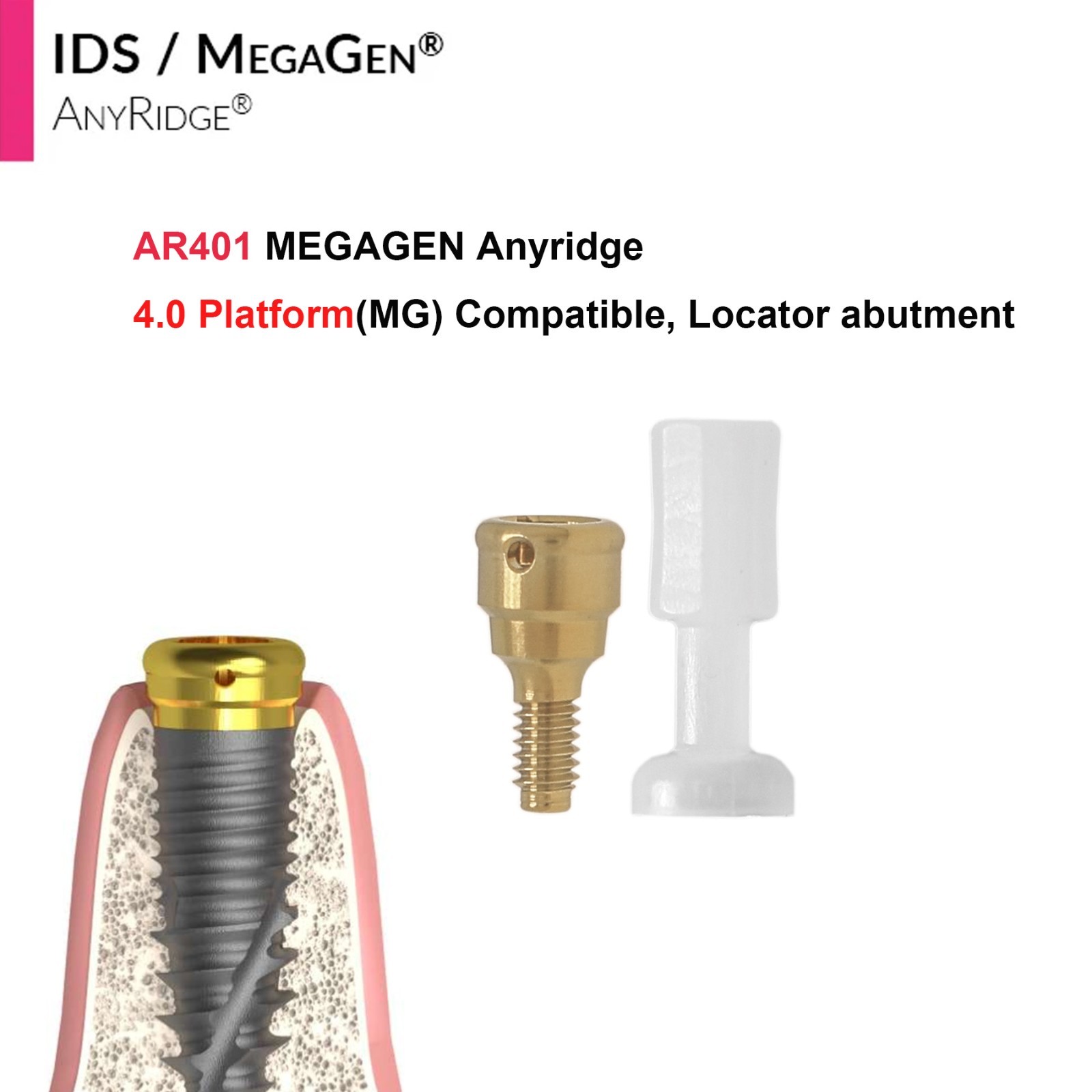 Implant Fit Zest Locator Abutment Hiossen/Nobel/Zimmer/GM/MegaGen /Straumann