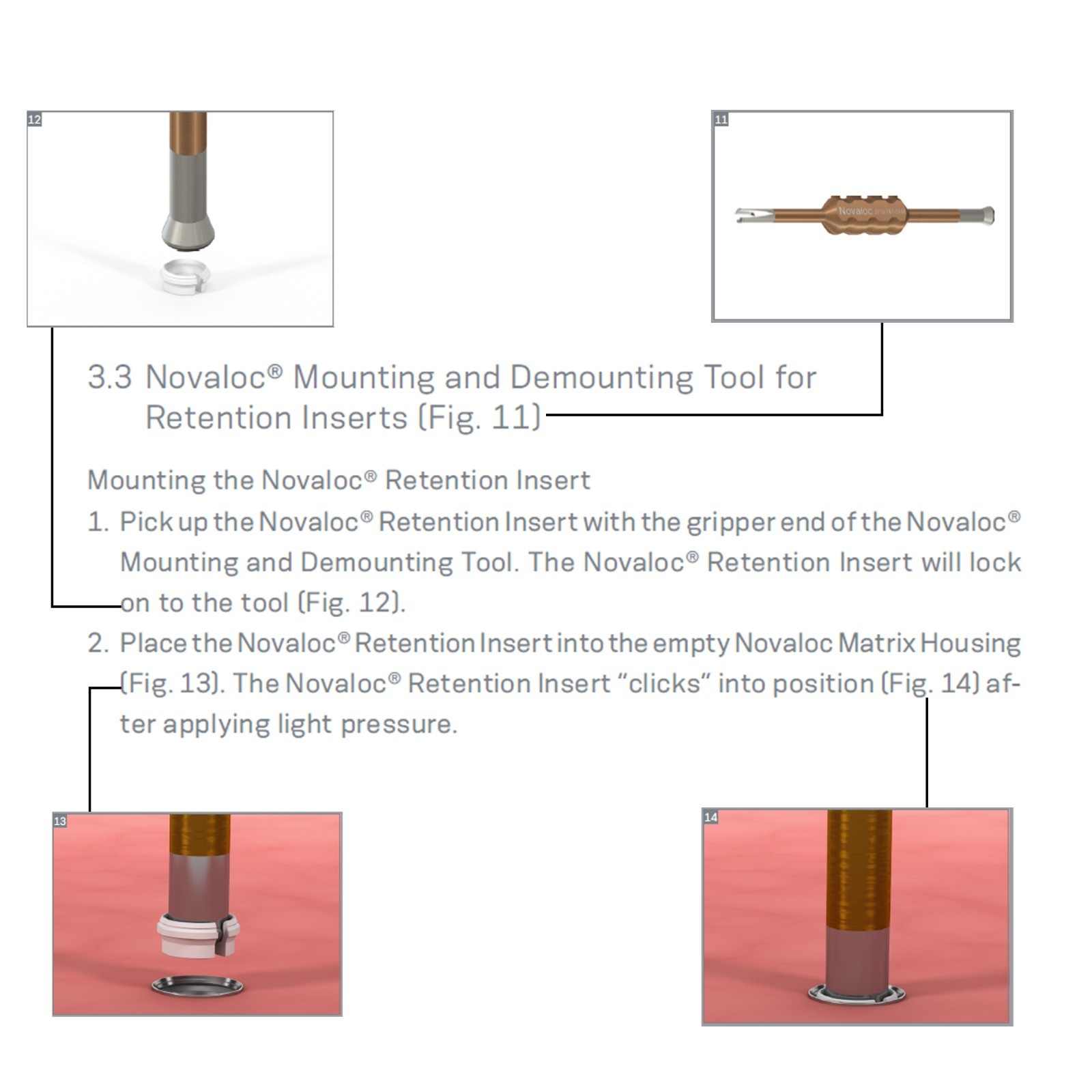 US Novaloc Processing Package PEEK Retention Inserts Tool Mounting & Demounting
