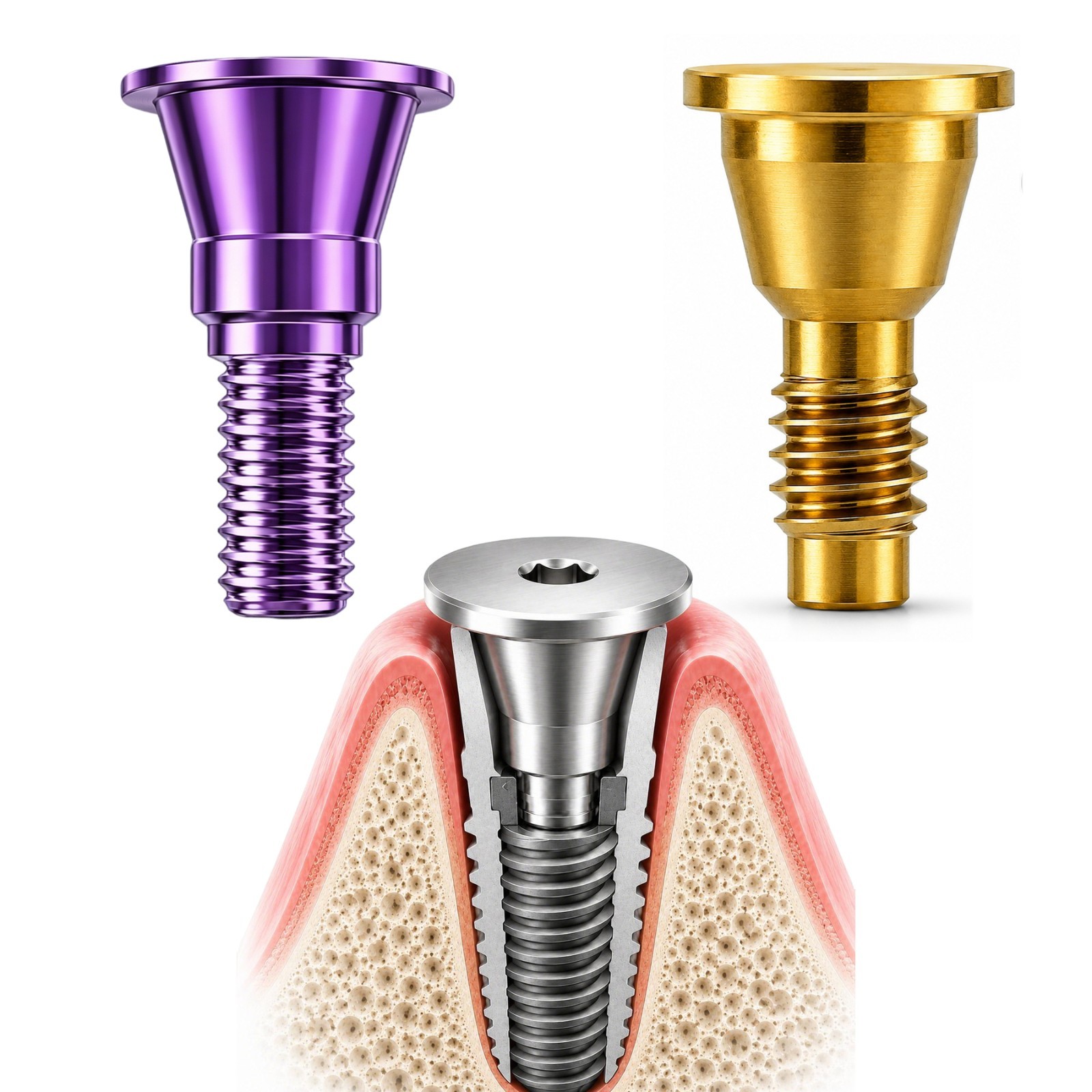 US Nobel Biocare Implant Cover Screw Conical Connection NP RP Closure Screw Cap