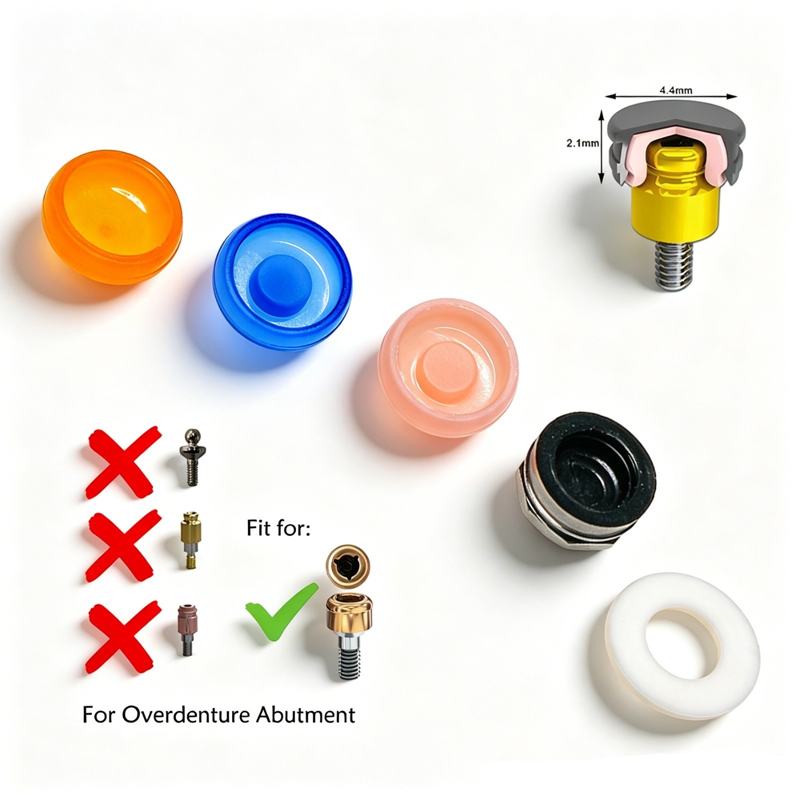 US Dental 5Pcs/set Overdenture Attachment Locator Retention Cap Male Cap Inserts