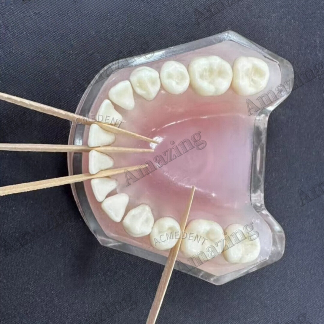 Dental Interdental Composite Contoured Wood Extra Large Wooden Wedges Matrices
