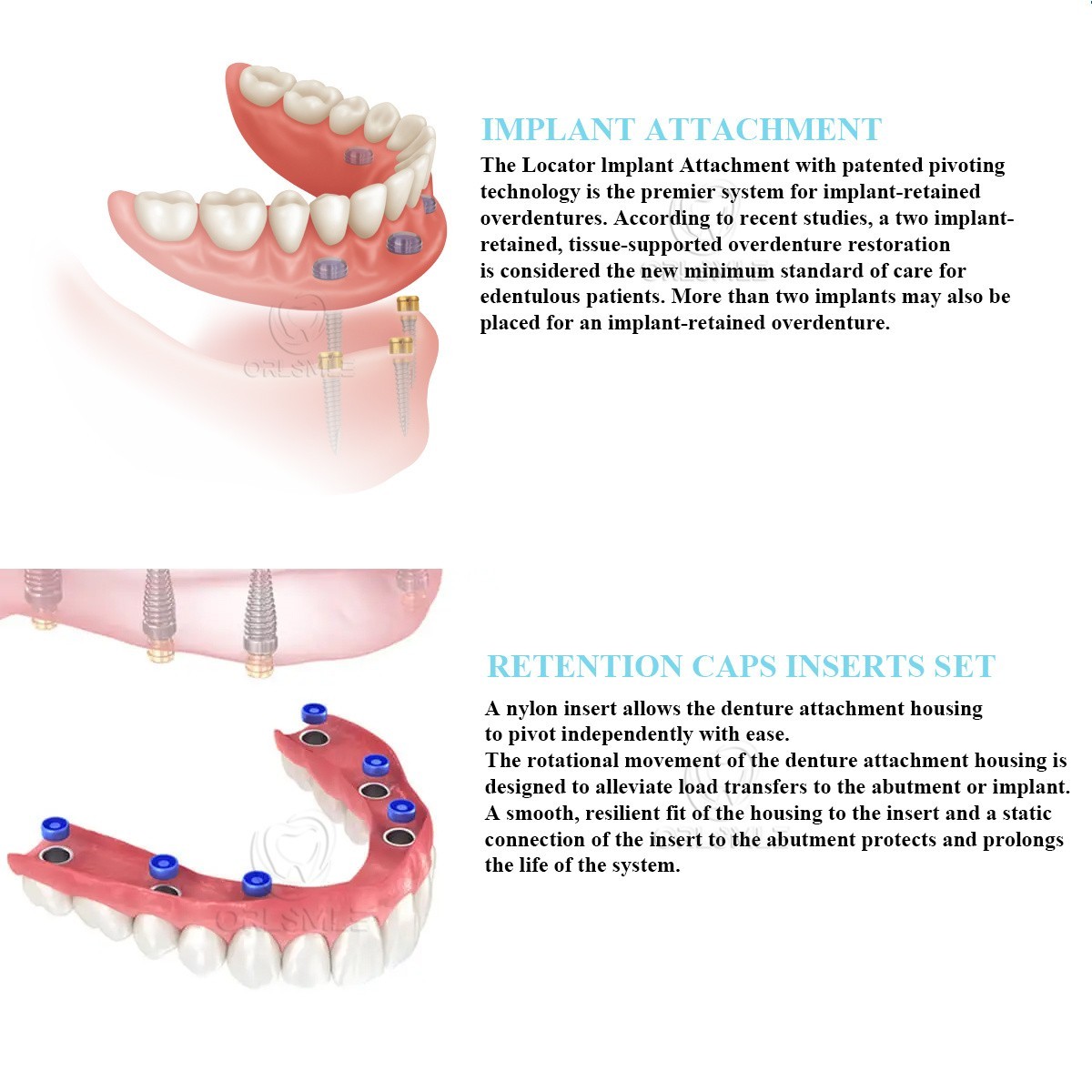 Locator abutment full set Male caps fit to Neodent GM GH1-6mm