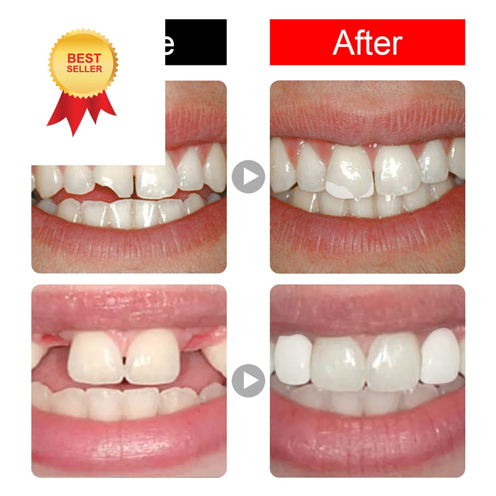 168 Pieces False Teeth Dental Complete Acrylic Resin Denture Teeth, 6 Sets…