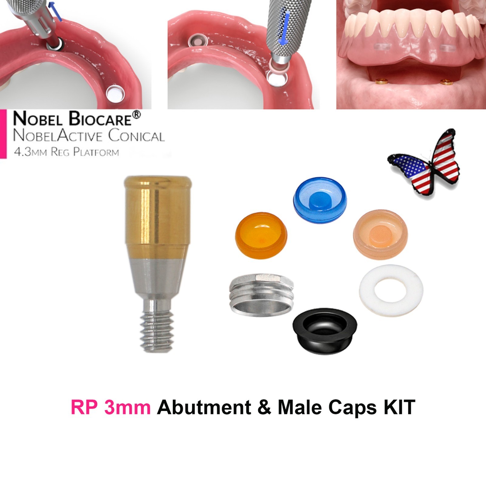 US Dental Locator Abutment NP/RP 3.5/4.3mm Fits Nobel Active Implant Overdenture