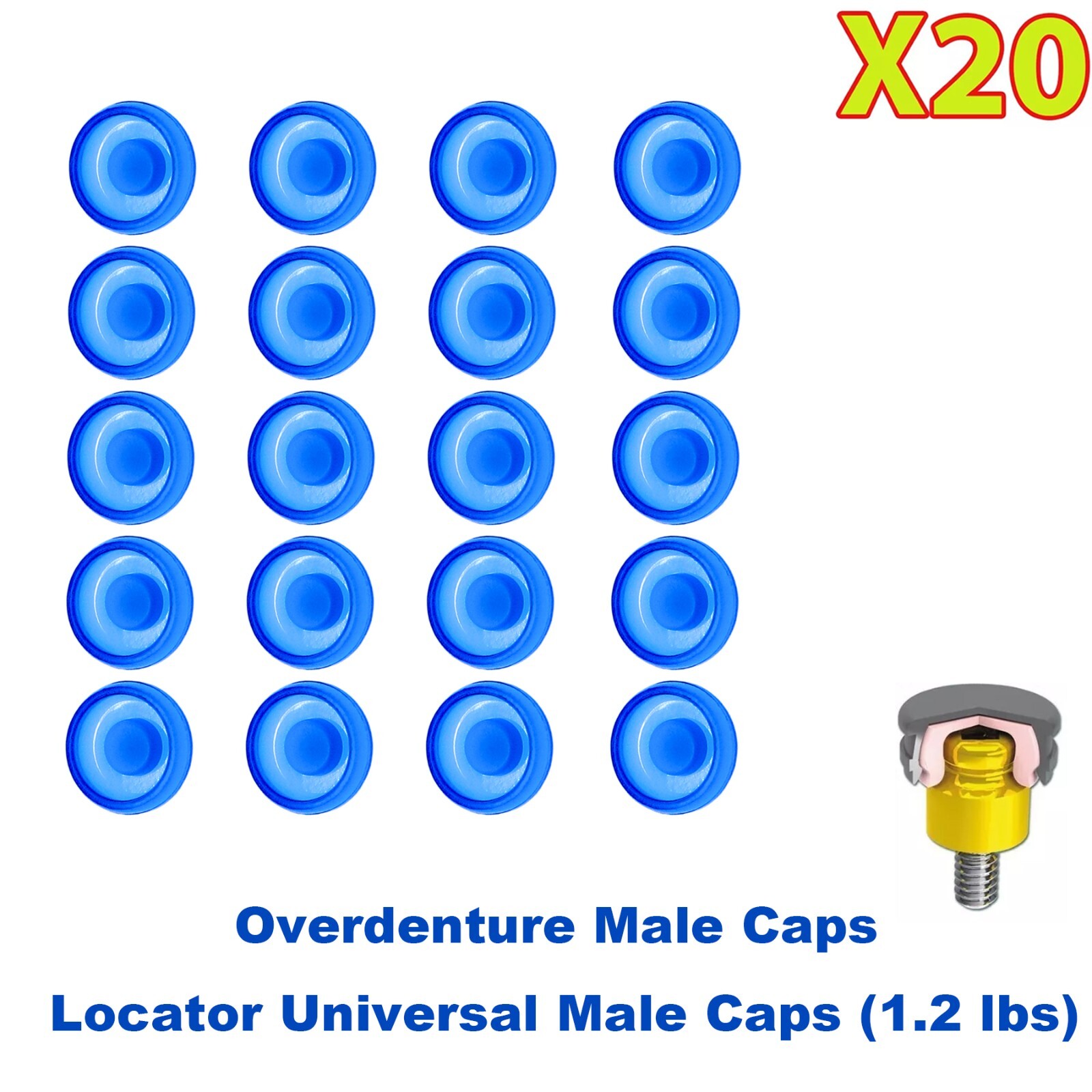 US 20Pcs Dental Overdenture Mini Implants Locator Retentive Caps 1.2/2.4lbs