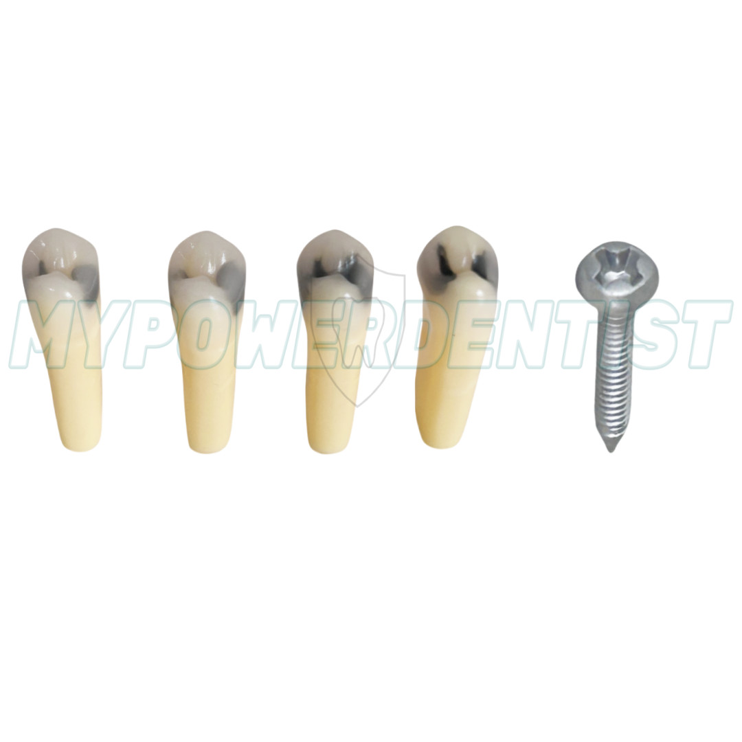 Dental Cavity Teeth Model Tooth Teaching Caries 25# Compatible Frasaco AG-3