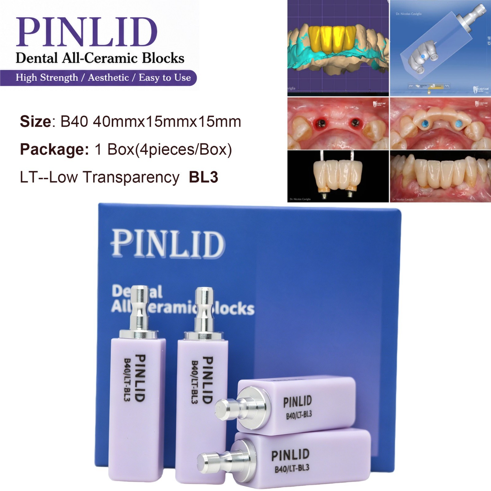 LT Dental Emax Glass Ceramic CAD CAM Blocks Lithium Disilicate CEREC 4pc/box