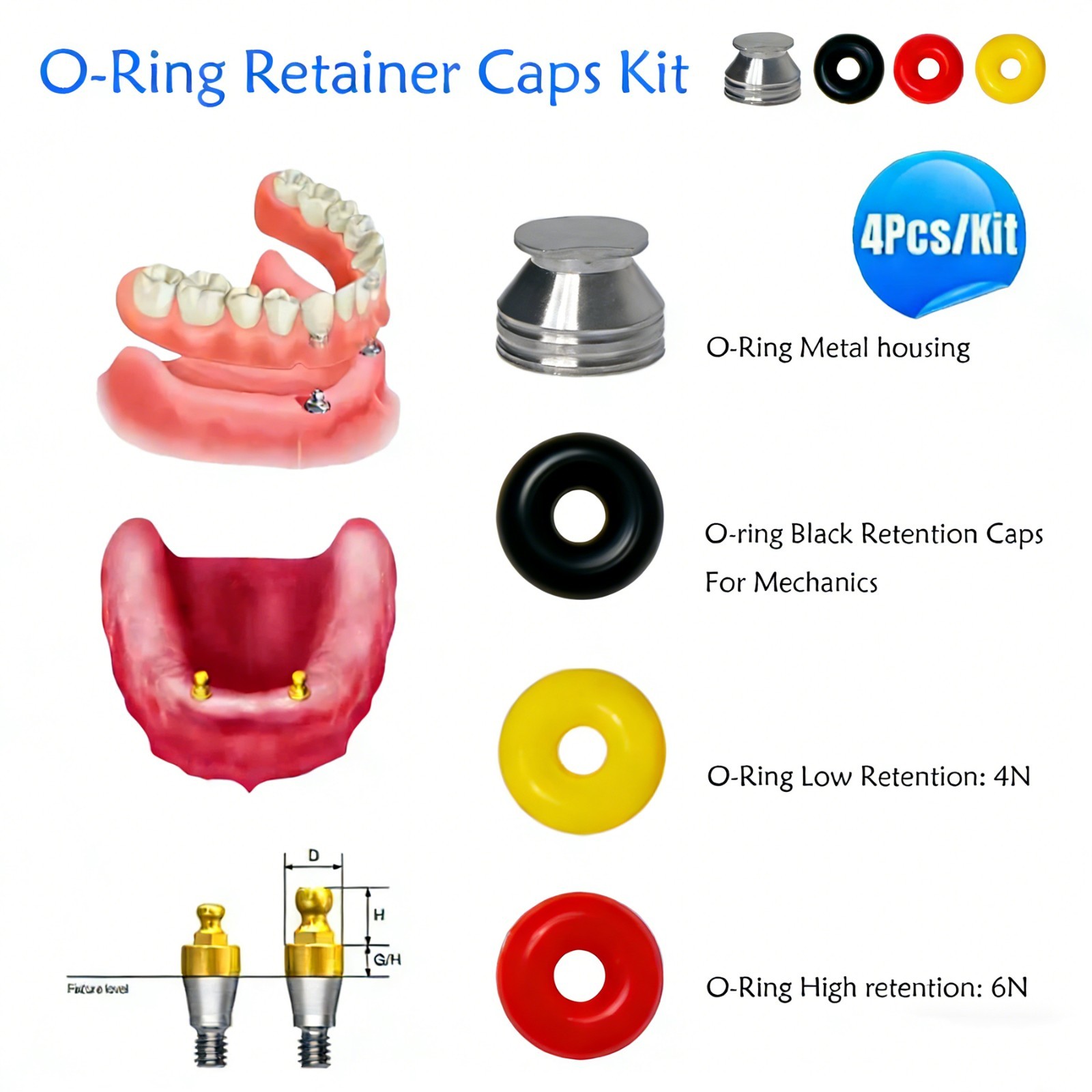 Dental Implant O-ring Retention Cap Kit For Hiossen/Osstem Ball Abutment 4pc/set