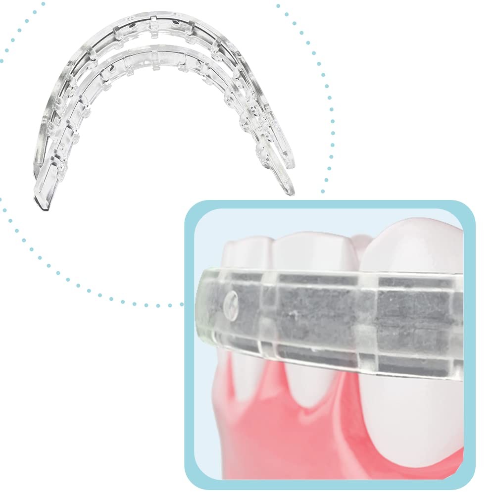 Comfort Cover for Braces, Lip Protector Mouth Guard Cushion Teeth Clear
