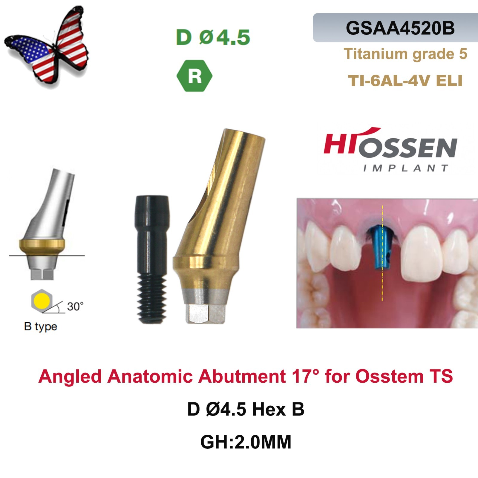 US 5Pcs 17° Angled Anatomic Abutment Hiossen Osstem Mini Regular Hex Titanium