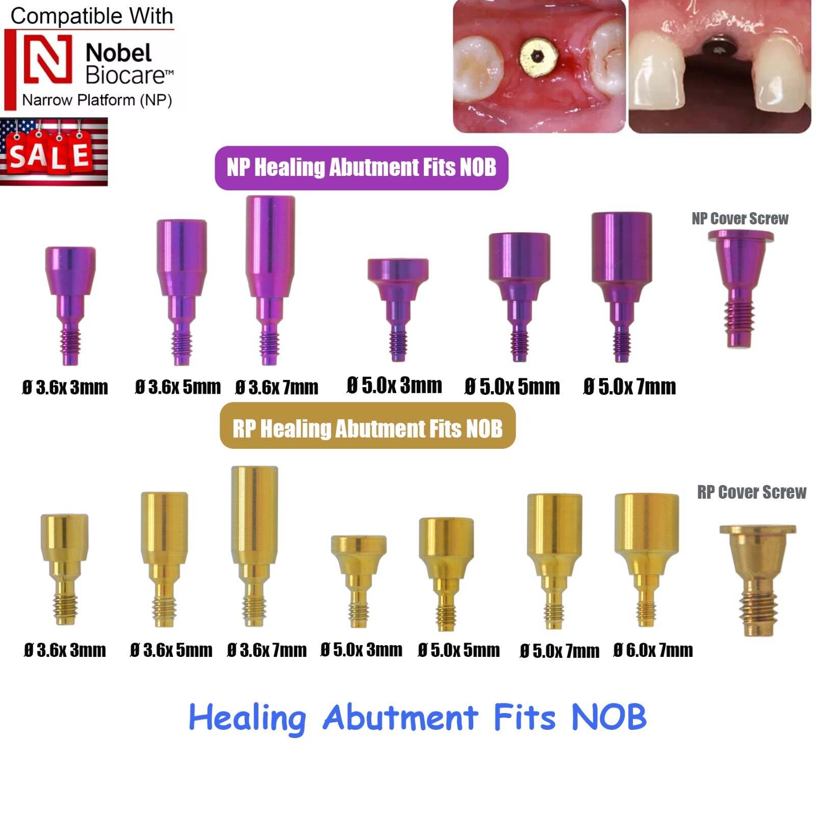 NobelActive Dental Healing Abutment Cap Fit Nobel Biocare Height 3/5/7mm RP NP