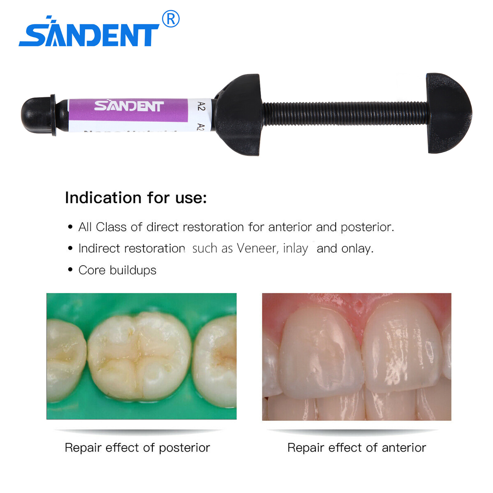 Light Cure Nano Hybrid Dental Resin Composite Syringe Shade A2 1 x 4.5 gram