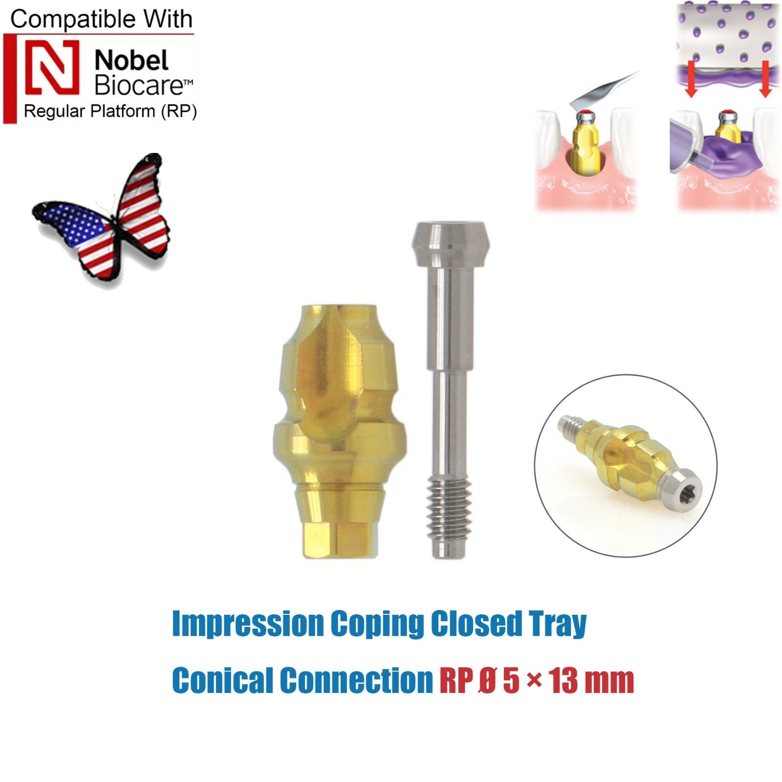 Dentaltech Closed/Open Tray Impression Copings Nobel Biocare Implant Compatible