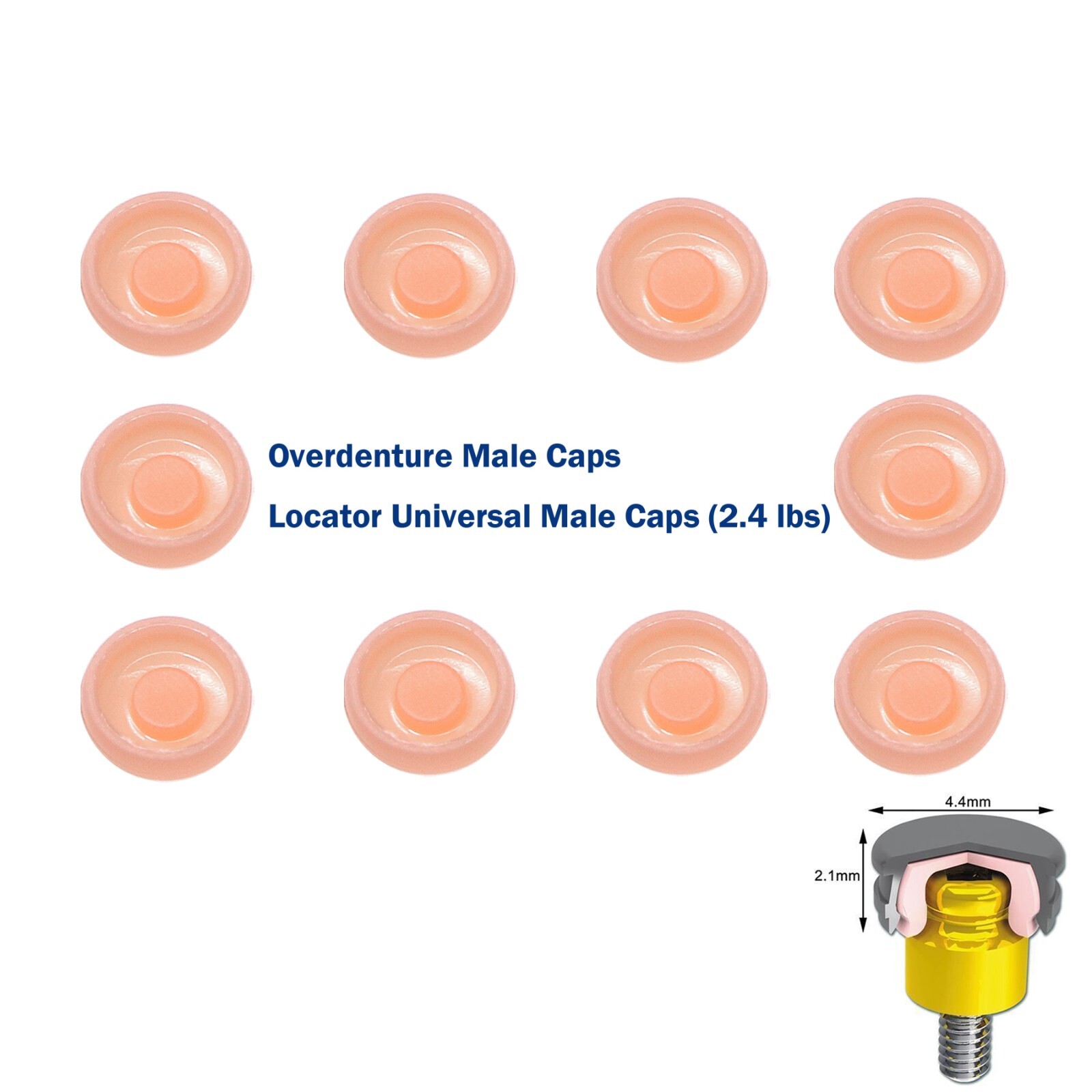 10Pcs Dental Locator Overdenture Abutments Retention Caps For Implant Inserts