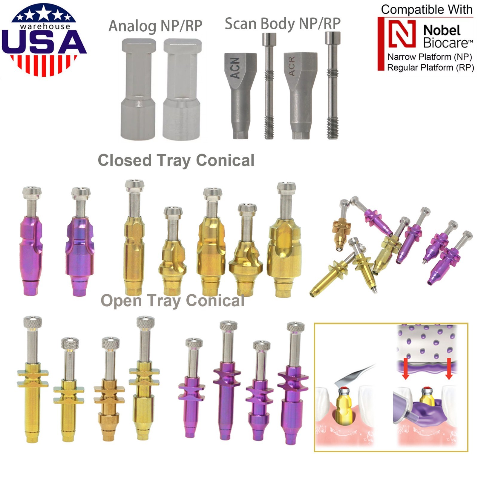 Dentaltech Closed/Open Tray Impression Copings Nobel Biocare Implant Compatible