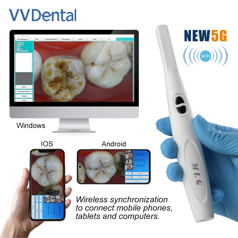 Dental Wireless Wi-Fi Intraoral Camera Portable Digital Oral Endoscope 1300MP