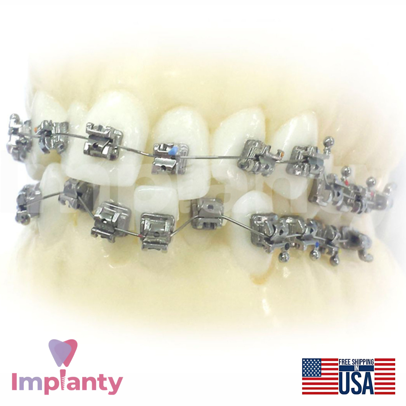 Morelli NiTi Thermo Copper CuNiTi Intraoral Rectangular Dental Archwire 10 Wires