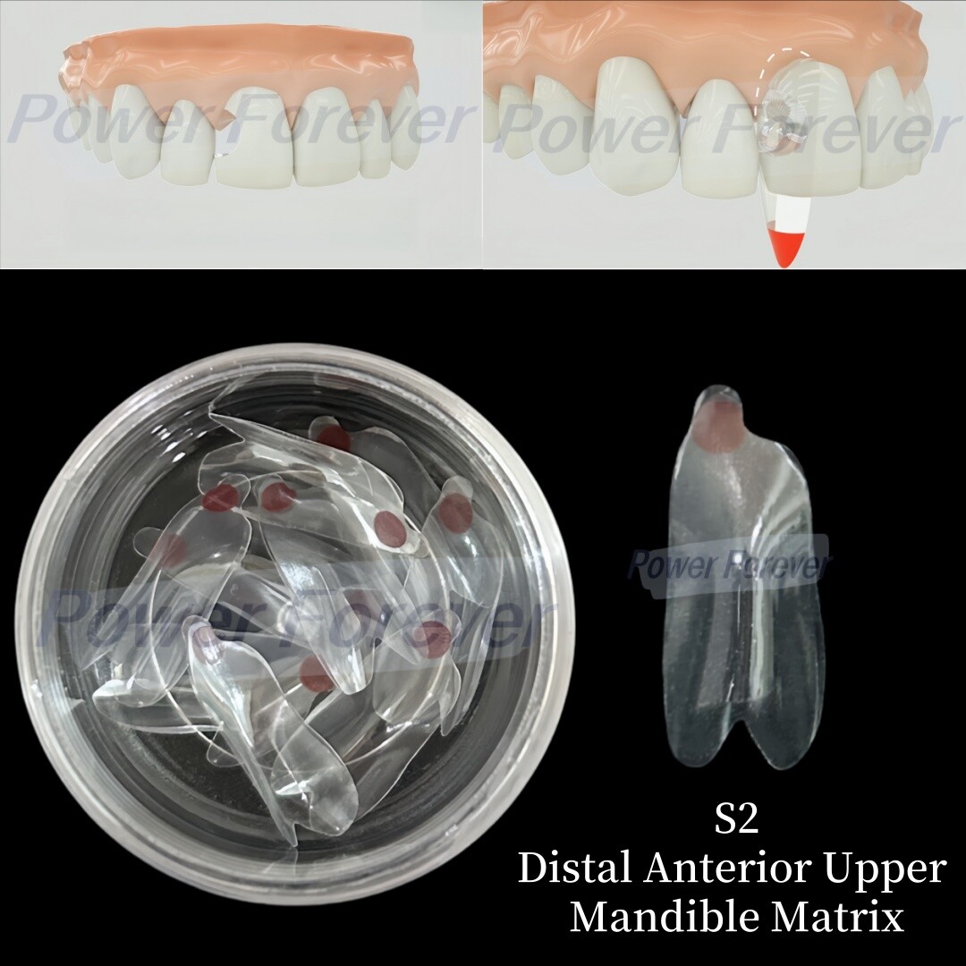 S2 Dental Anterior Distal Matrix Clear BT Bow Maxillary Matrices Contoured