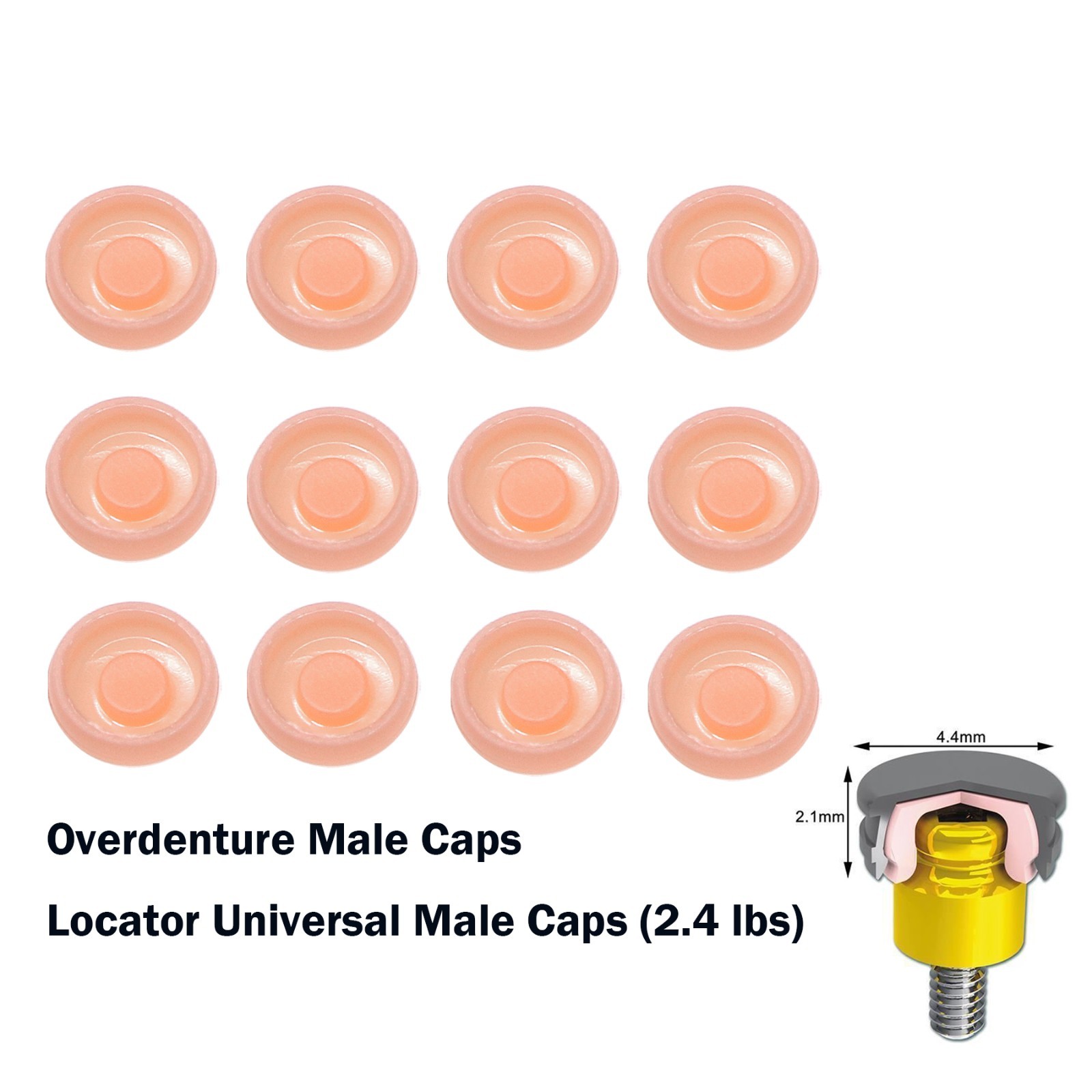 Dental Overdenture Locator Implant Abutment Retention Caps Male Cap Inserts Set