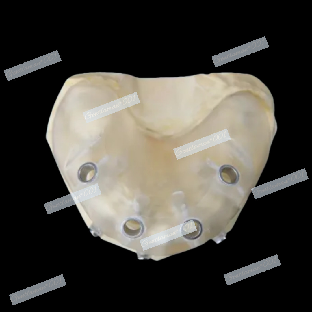 Dental Implant Pilot Anchor Drill Fixing Nail Guide Sleeves Digital Jaw ∅2.0mm