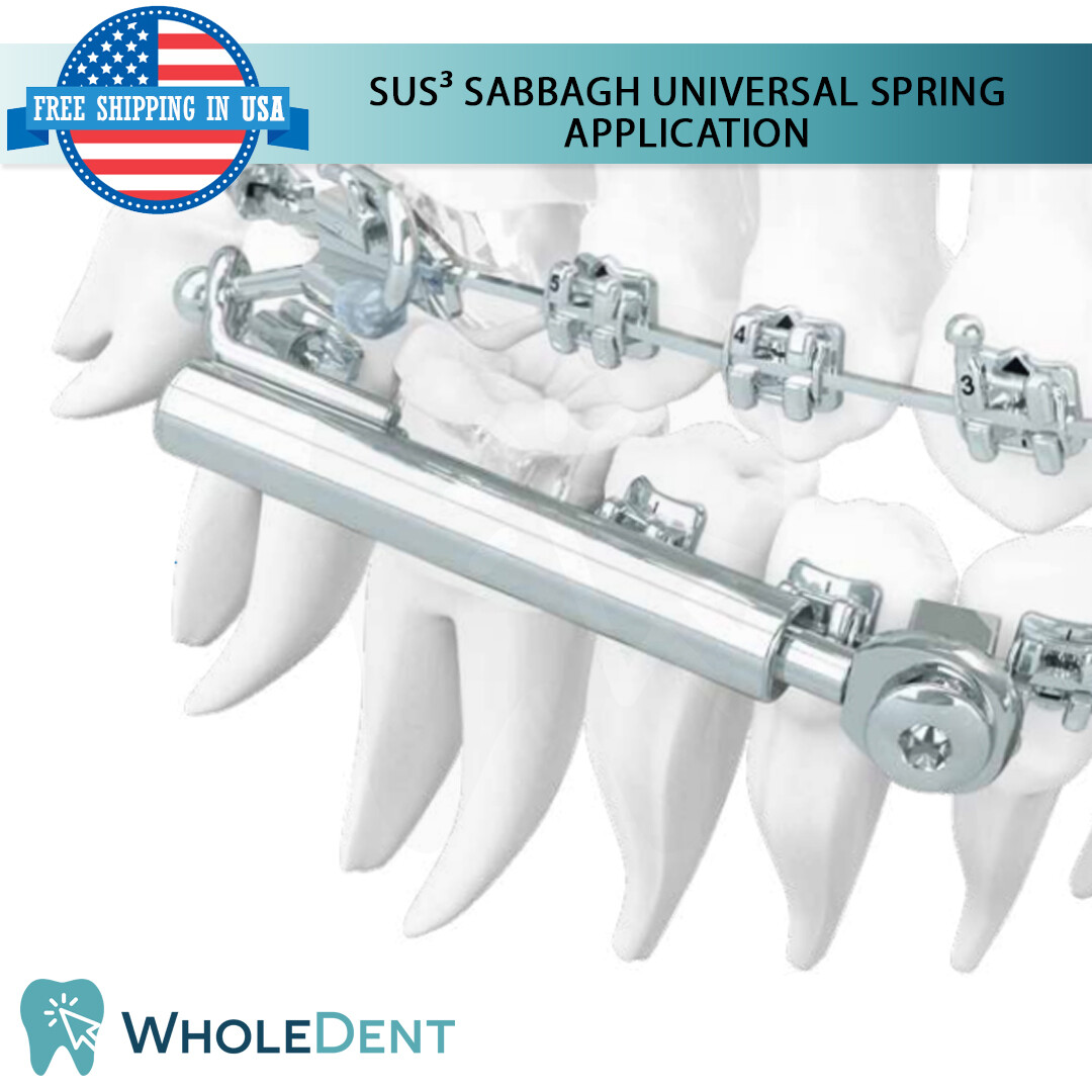 Orthodontic Dental SUS³ Sabbagh Universal Spring Small Set Application