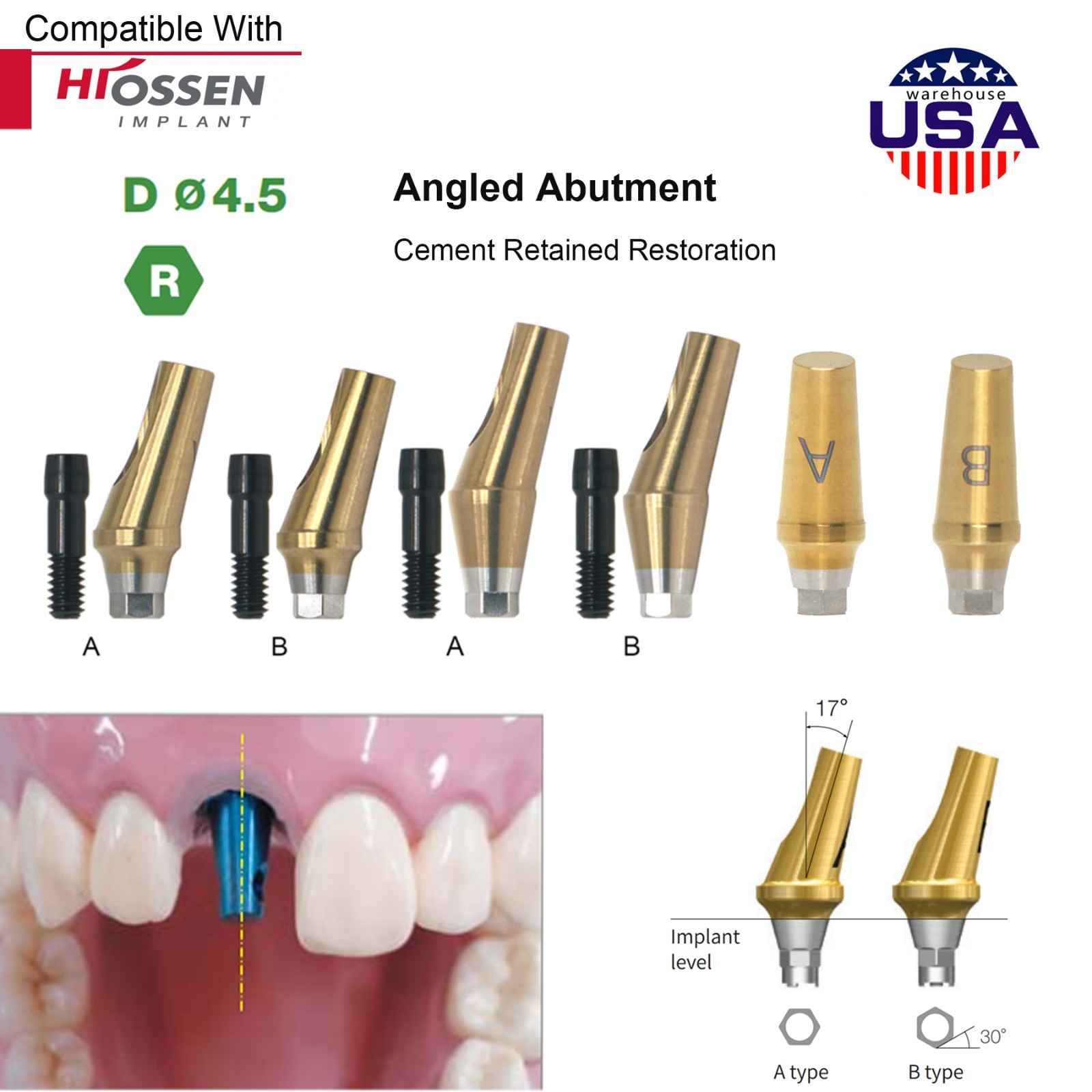 US Osstem Hiossen TS ET 17° Angled Abutment Regular Platform Ø4.5mm Titanium Hex