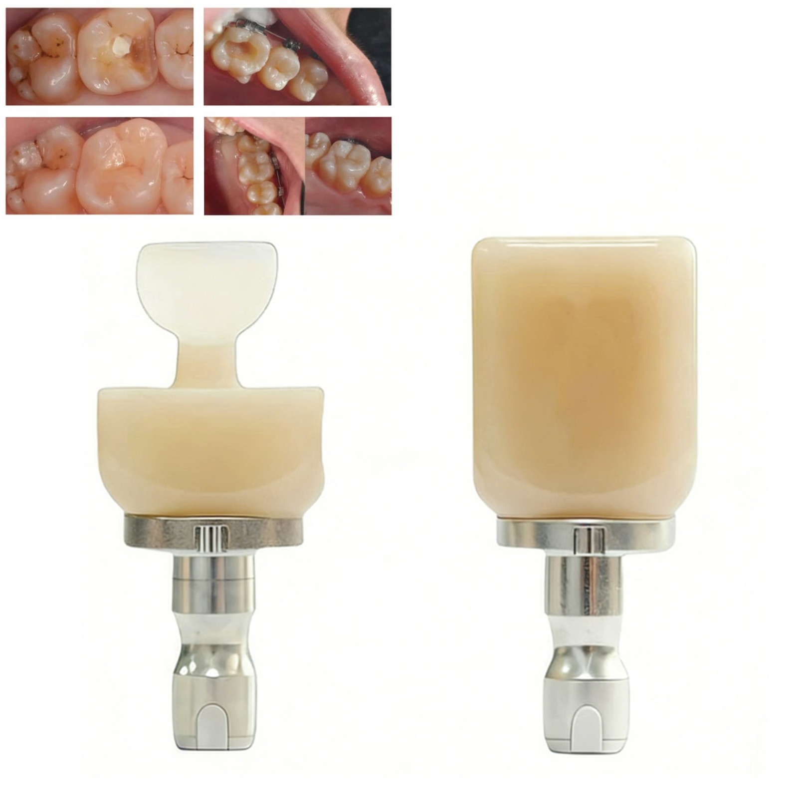 C14 Emax CAD/CAM All-Ceramic Dental Glass Without Sintering Cerec Block 5PCS/BOX