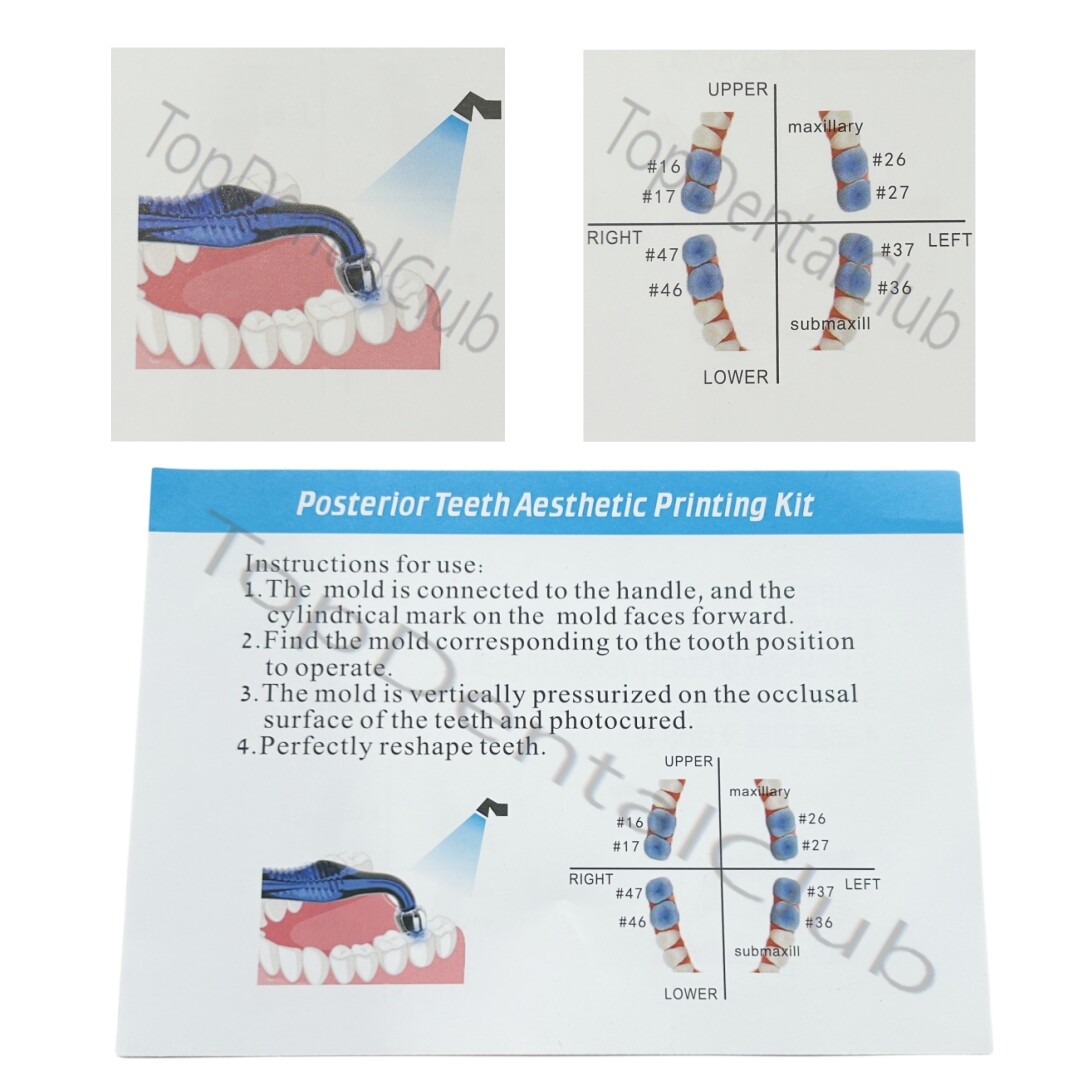 Dental Posterior Teeth Aesthetic Printing Mould Kit Restoration Filling Tools