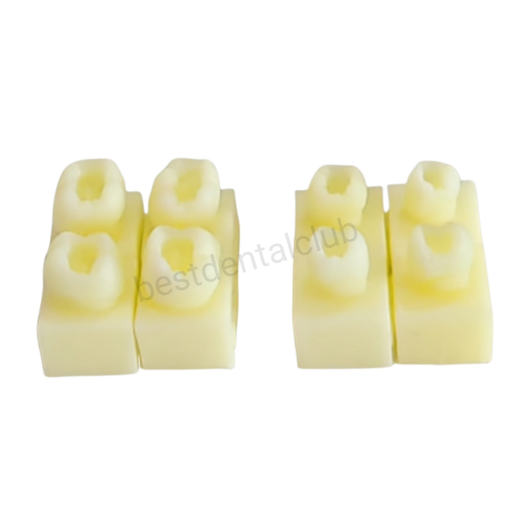 1Set Dental Molar Caries Decay Teeth Model Composite Resin Restore Tooth Simulat