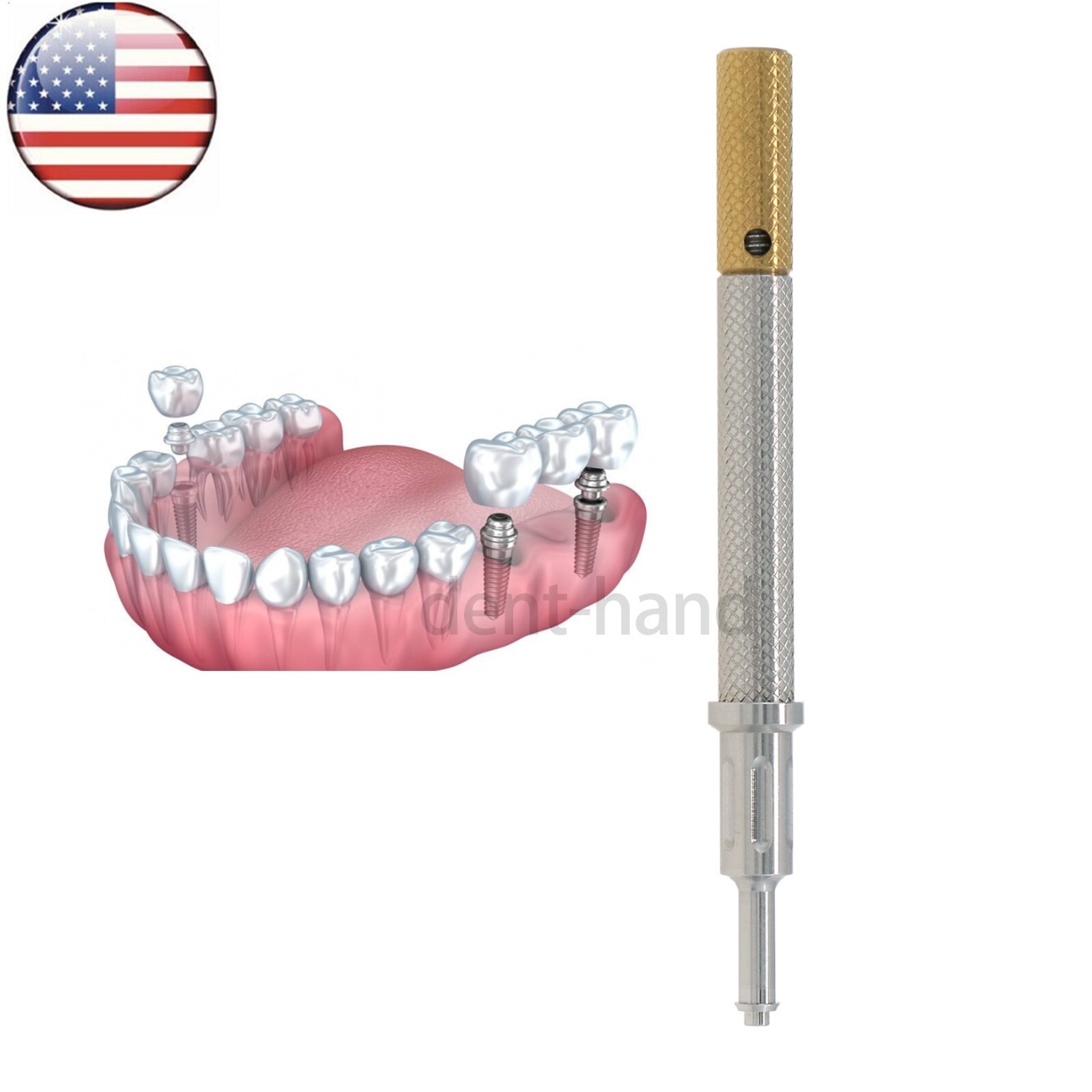 US Dental Universal Implant Denture Caps 3-IN-1 Remove Core Tool
