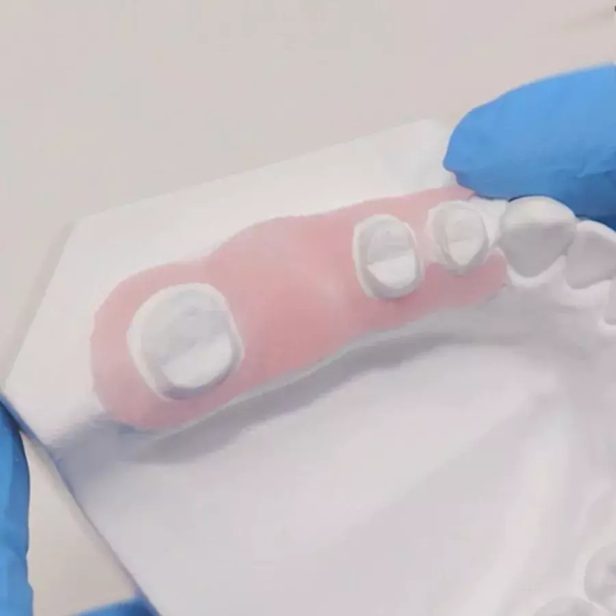Vincismile Perfit A-Silicone Gingival Mask Synthetic Rubber-Based Material.