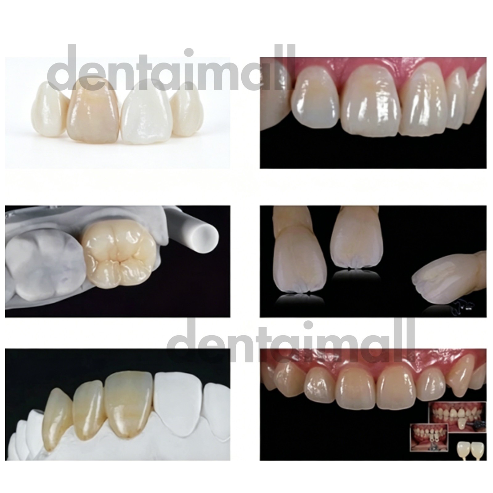 US 5PCS C14 LT Dental Glass Ceramic Lithium Disilicate Blocks Emax CAD/CAM