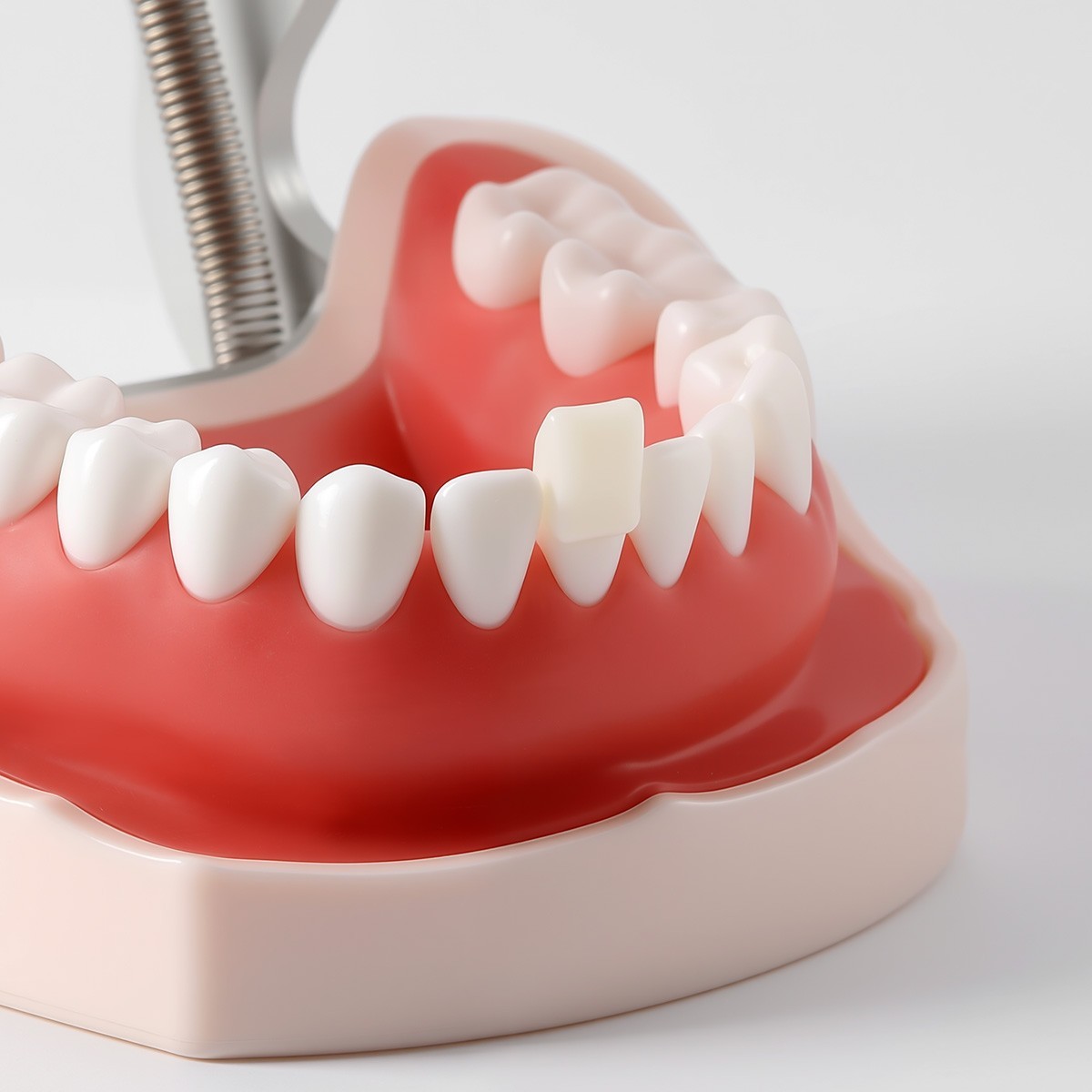 Temporary Dental Crown Resin Anterior Posterior Teeth Mixed Sizes Natural Color