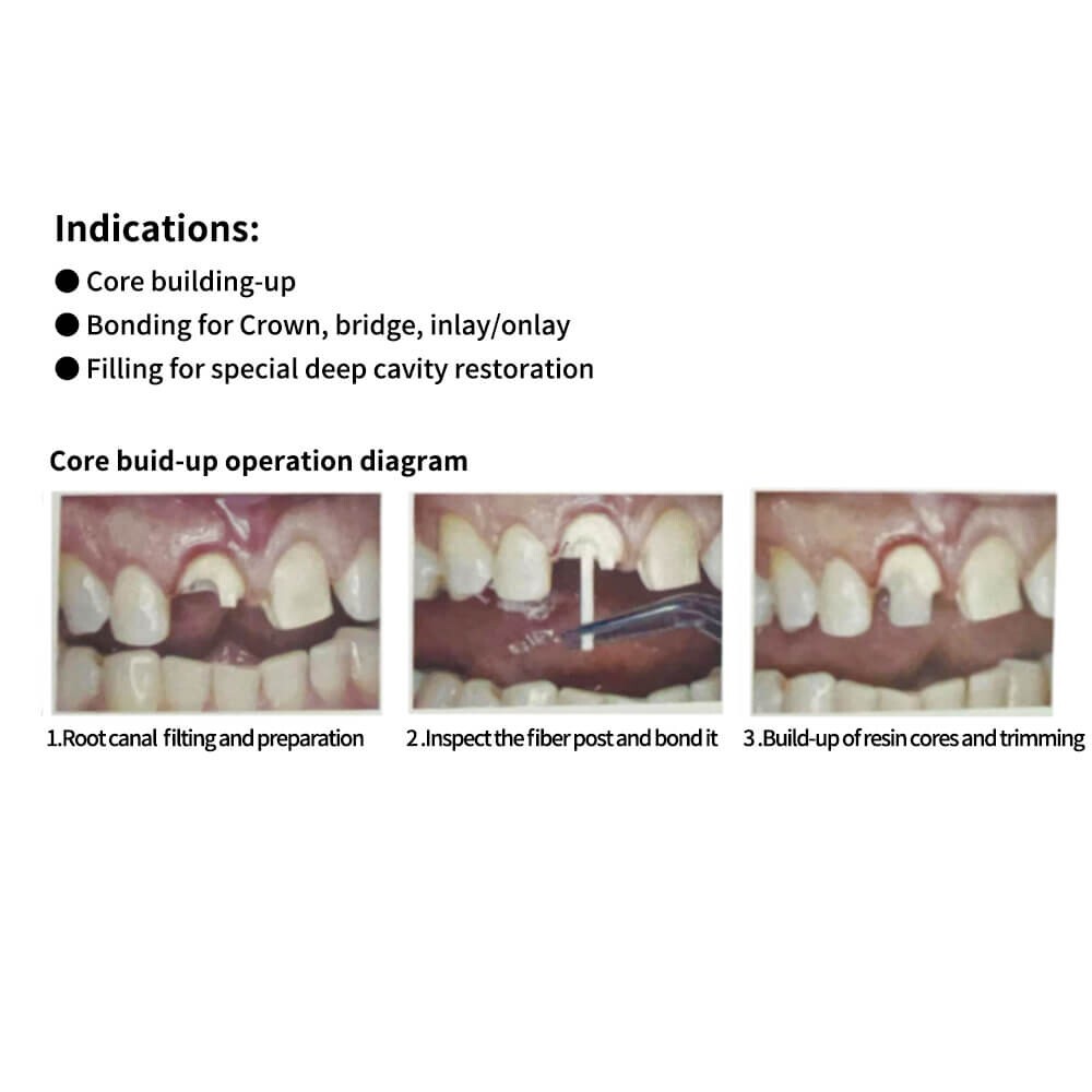Dental DX.CORE dual cure core build-up composite dental cement 8g A2 A3 Color