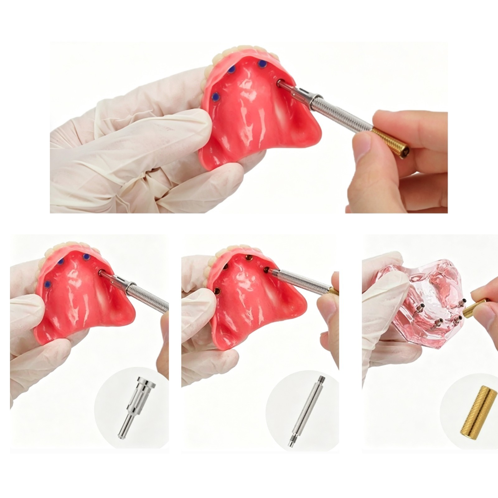 US Dental Multi-functional Locator Core Tool And Overdenture Retention Caps