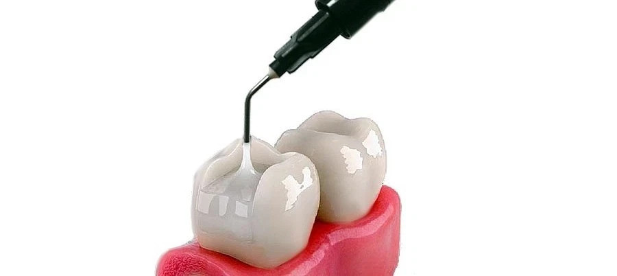2 x META Dental NEXCOMP FLOW Nano Hybrid Flowable Composite Resin 2gm SyrFREE FS