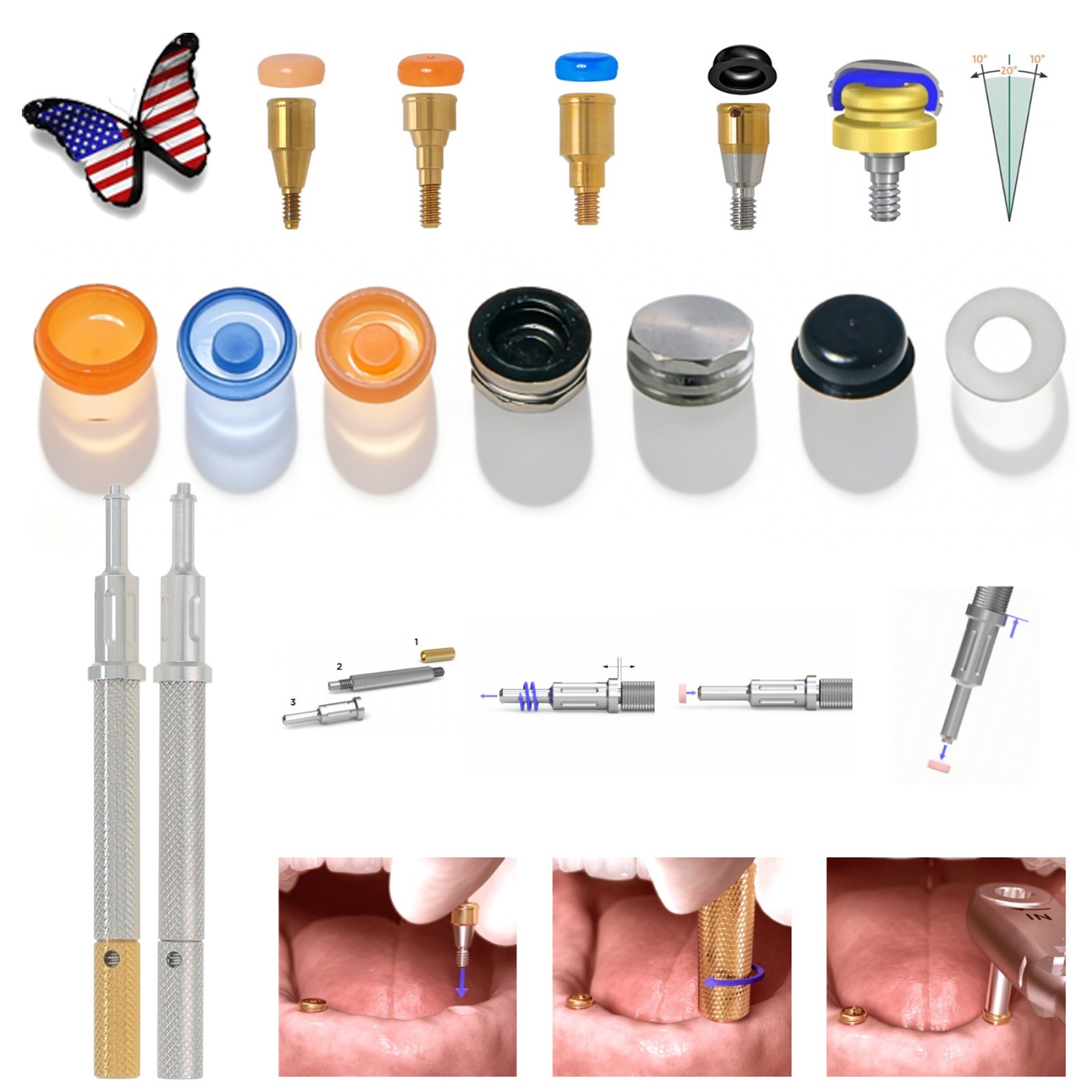 US Dental Locator Abutment Male Caps Kit Fit Hiossen Nobel Zimmer Implant System