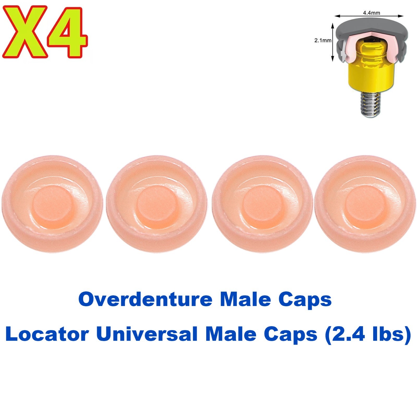 US Implant 2.4 lbs Overdenture Retention Caps For Locator Core Tool Universal