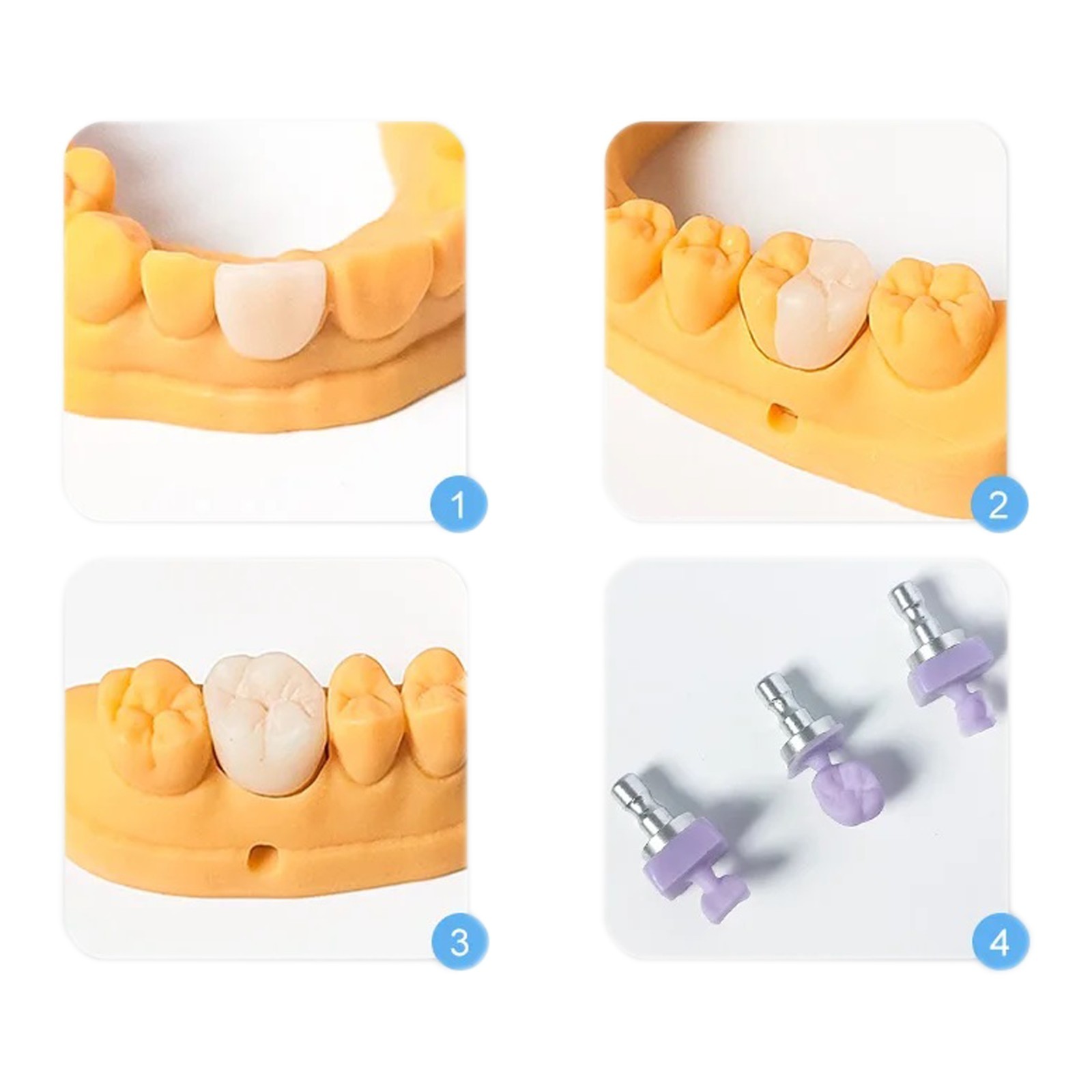 US Dental Lithium Disilicate Glass Ceramic Blocks C14 HT CAD CAM CEREC Blocks