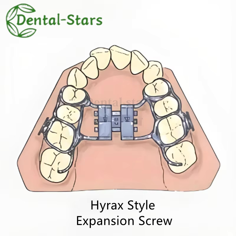 MSE Dental Ortho Expansion Screw Mid Facial Rapid Palatal Split Hyrax Expander