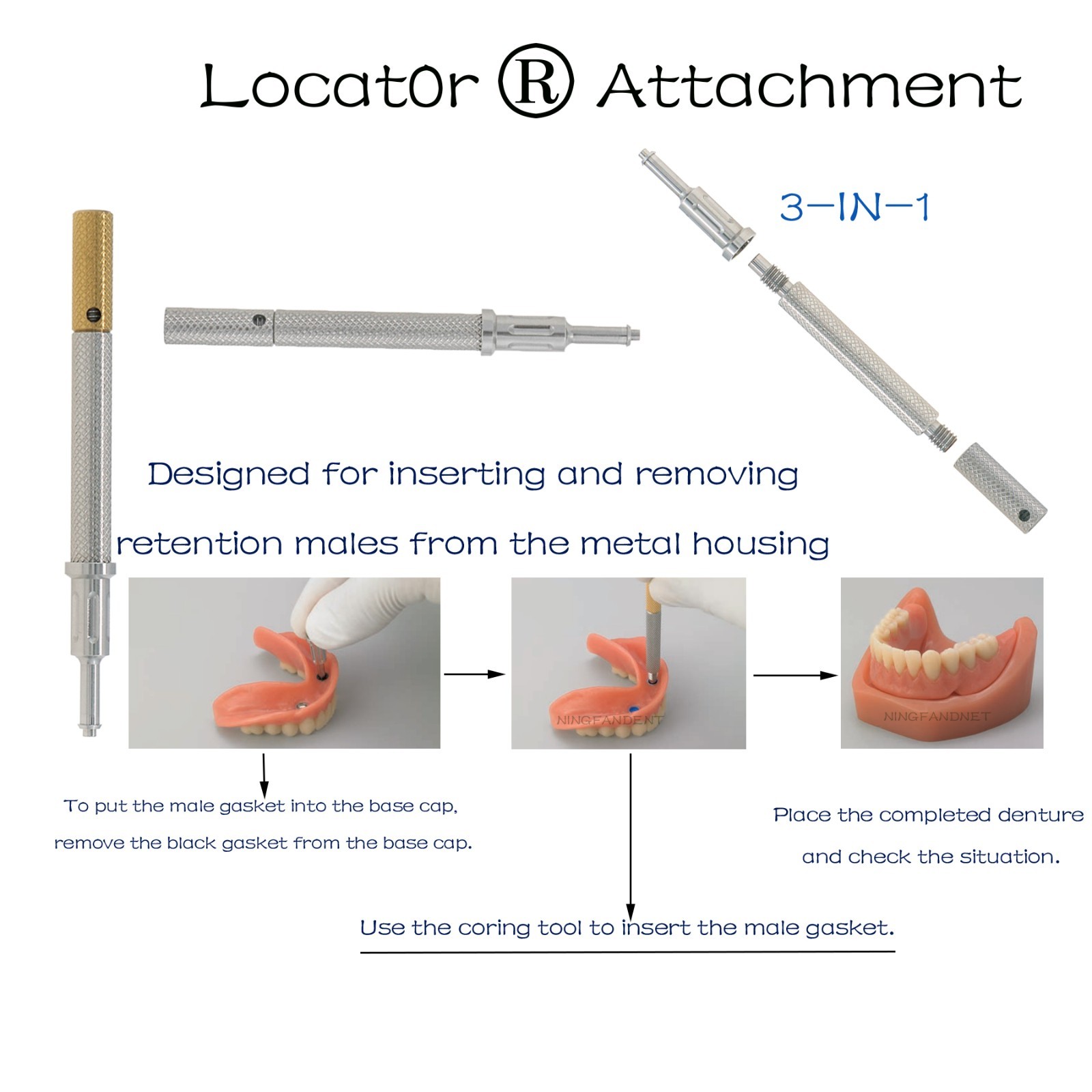 Overdenture Locator Abutment Fits Hiossen/Zimmer TSV/Nobel/Bego/Mis CC-Hex Plat