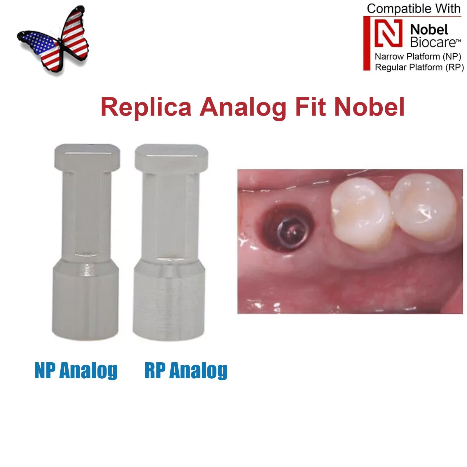 Dentaltech Closed/Open Tray Impression Copings Nobel Biocare Implant Compatible