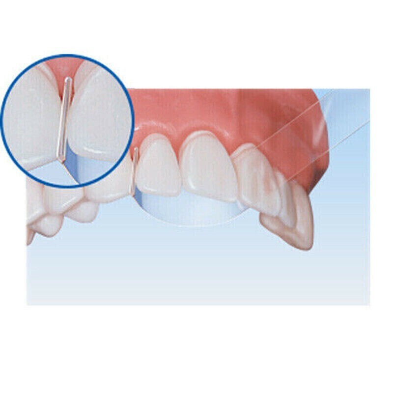 1 Box TOP BM Dental Transparent Strip Clear Plastic Strips Crown 10MM 1.041