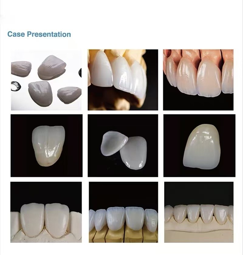 US Dental Emax Lithium Disilicate Glass Ceramic Blocks C14 LT CEREC CAD/CAM