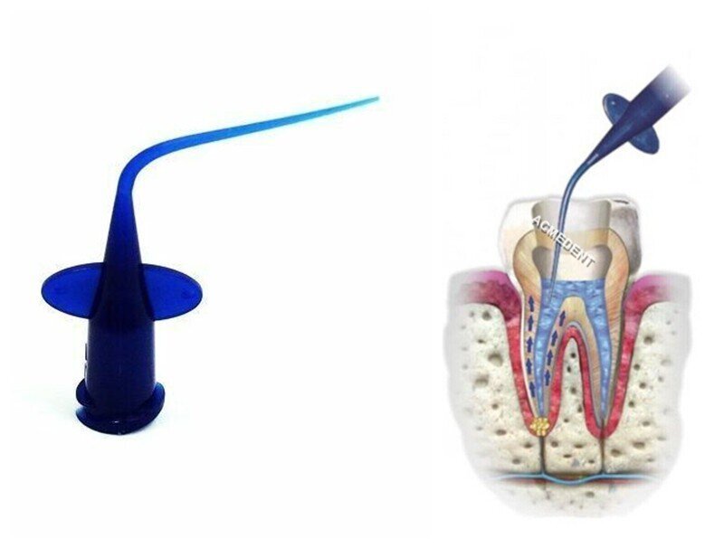 Dental Disposable Irrigation Tip Endo Root Canal Irrigator Tip Plastic Blue