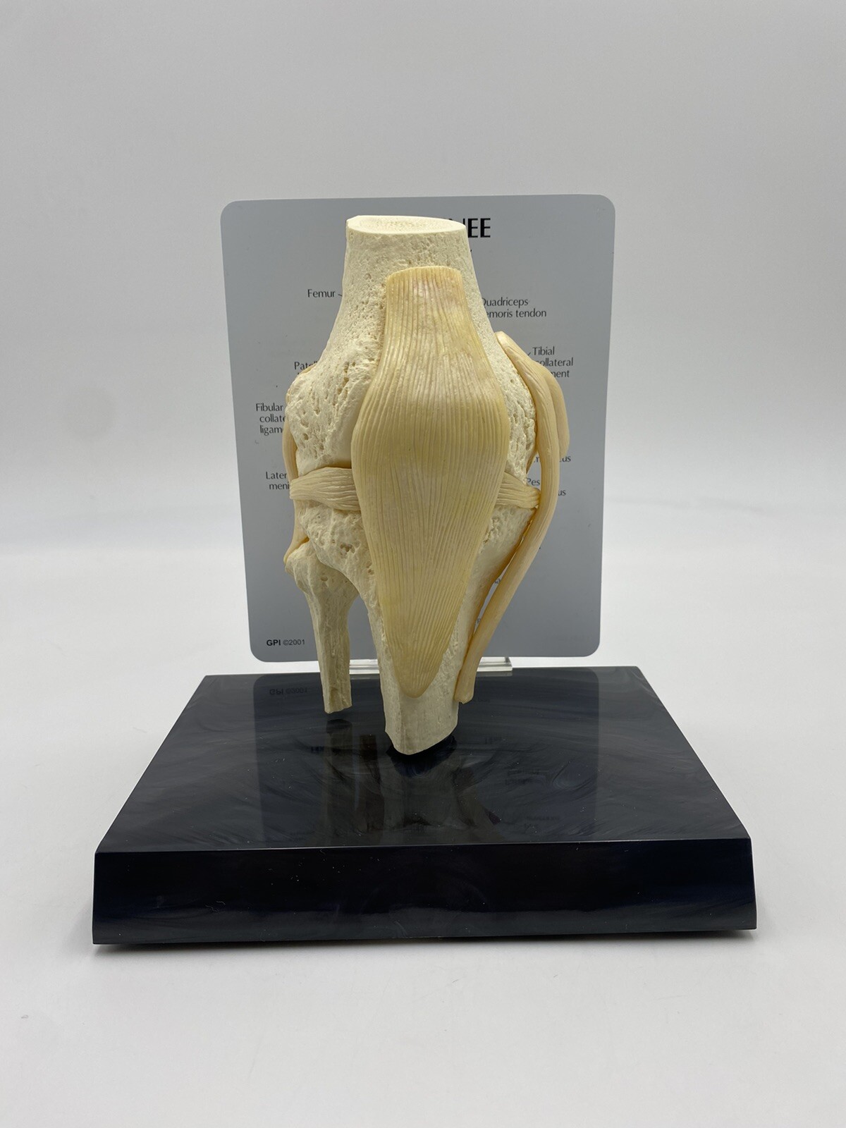 GPI Anatomical – GP1000 – Basic Knee Join Model