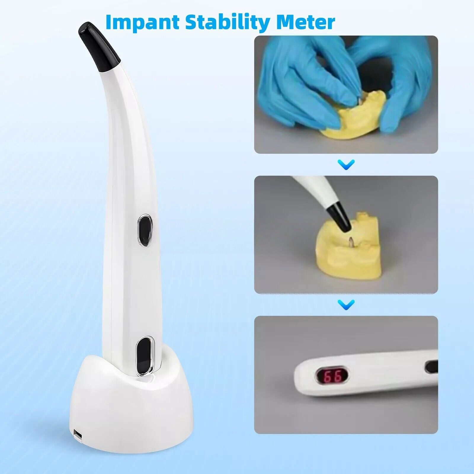 2025 Dental ISQ Implant Stability Device Dental Implant Monitor Osseointegration