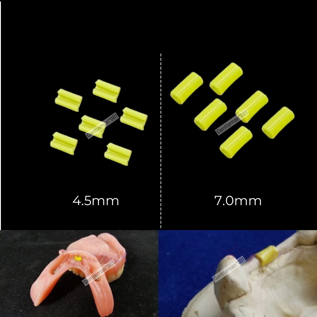 10Kits Dental Overdenture Attachment Blue Bar Yellow Clips Bolt Inserts Implant